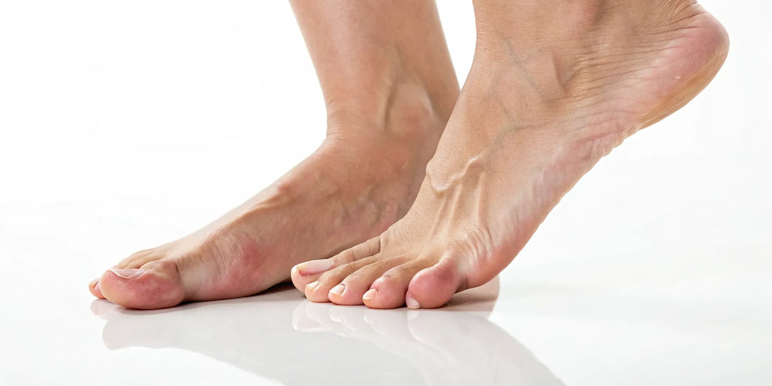 A close-up of feet, used to identify the location of foot pain.