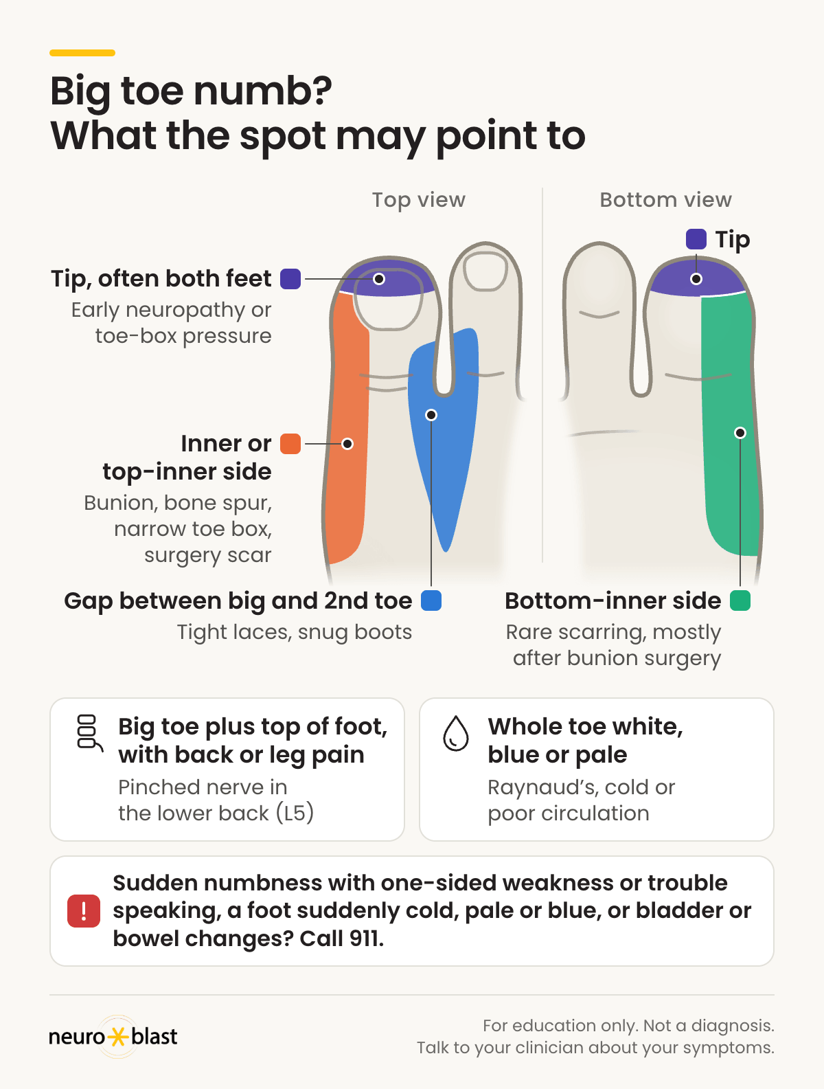 Big toe numbness map, top and bottom views of one foot: gap between the big and 2nd toe (tight laces, snug boots); inner or top-inner side (bunion, bone spur, narrow toe box, surgery scar); bottom-inner side (rare scarring, mostly after bunion surgery); tip, often both feet (early neuropathy or toe-box pressure). Big toe plus top of foot with back or leg pain can be a pinched L5 nerve in the lower back; a whole toe that is white, blue or pale points to Raynaud's, cold or poor circulation. Call 911 for sudden numbness with one-sided weakness or trouble speaking, a foot suddenly cold, pale or blue, or bladder or bowel changes.